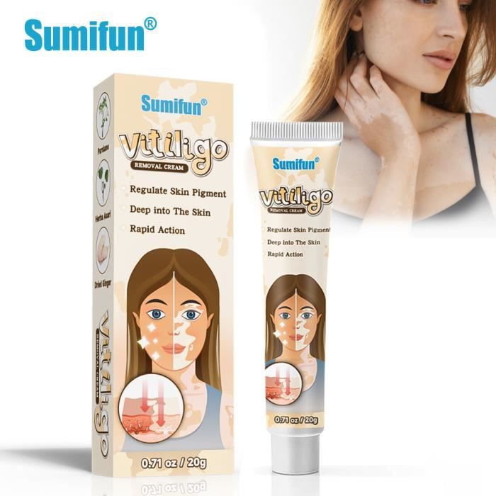Gel Crème VITISTOP 50 Ml Pour Vitiligo - Aide à La Repigmentation Progressive, Peaux Sensibles