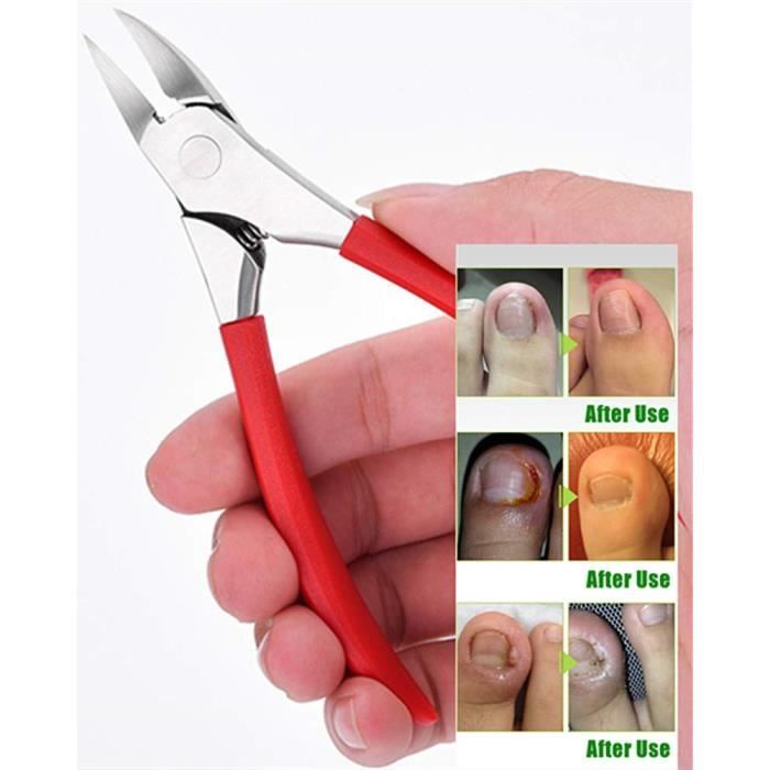 Tondeuse à ongles pour ongles épais ou incarnés à bord droit de précision à long manche, ciseaux pour les personnes âgées et
