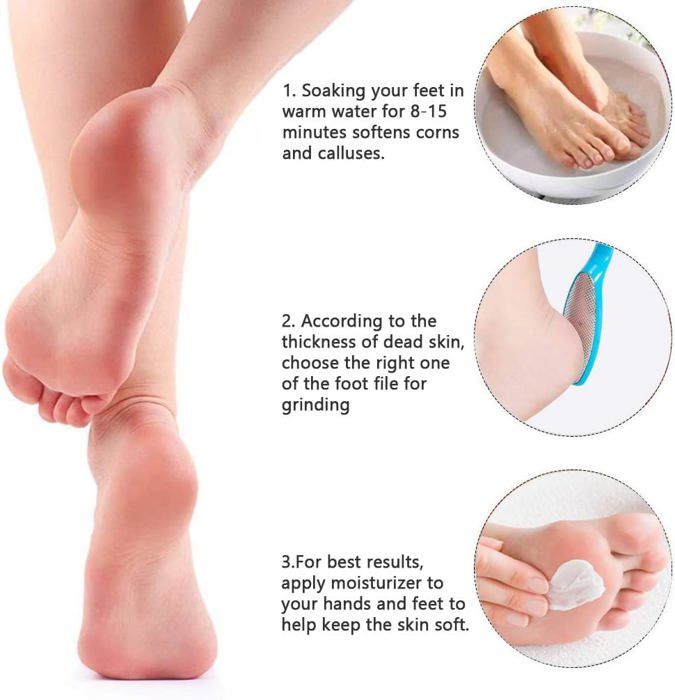Râpe Exfoliante Pour Pieds - Lime Callosités - Manuel En Acier - Couleur Aléatoire