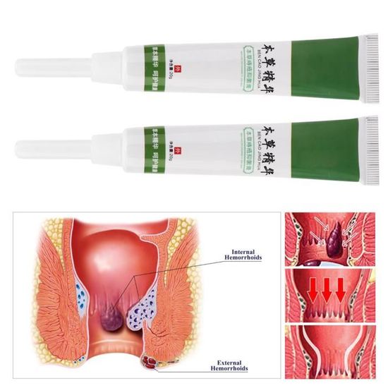 2pcs Creme Hemorroides Aux Herbes Onguent De Traitement Hemorroides Soulagement D Anus Prurit Cdiscount