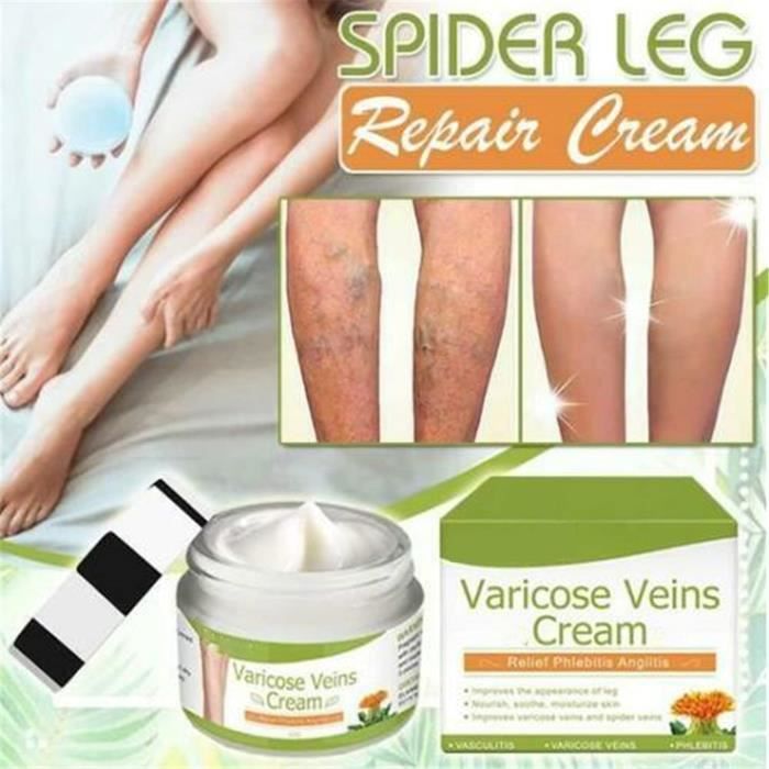 Varices Crème, Varices Traitement Jambes Crème, Veines Araignées — free download