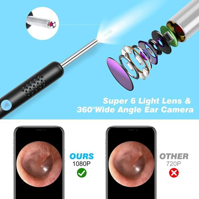 Otoscope Oreille,SPECOOL Endoscope Oreille,1080P Camera Oreille,6 Lumières  LED,Convient aux Smartphones Tels que iPhone et Android - Cdiscount  Electroménager