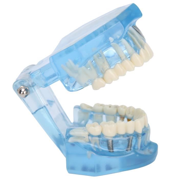 Modèle Dentaire Américain Avec Joue De Simulation - 32 Dents, Compatible Kilgore NISSIN 200