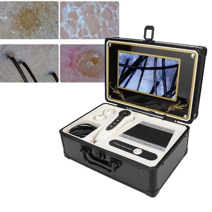 Microscope Numérique Portable Dermatoscope - Grossissement 500x, Résolution 1920x1080 - Pour Analyse De Peau, Cuir Chevelu, Cheveux