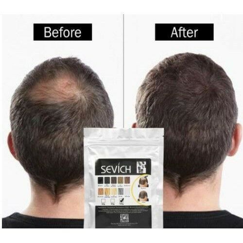 Poudre Densifiante Cheveux Noir Toppik - Kératine Fiber 27,5 G - Pour Cheveux Clairsemés
