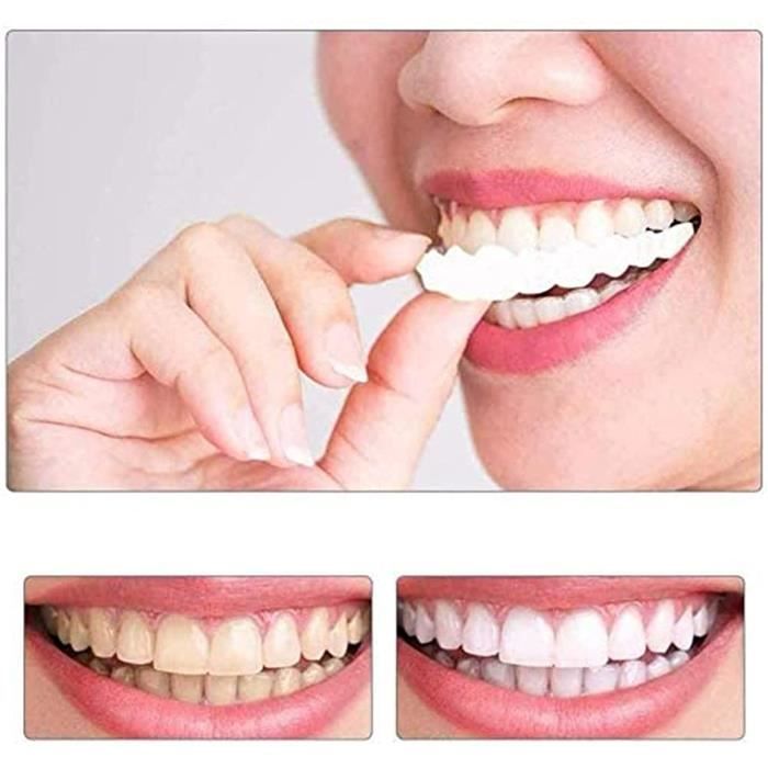 2 Paires Prothèse Dentaire Cosmétique,Fausse Dent Naturel a Poser, Dentier  Sourire Parfait, Dentier Provisoire Dentier Amovible Haut - Cdiscount Au  quotidien