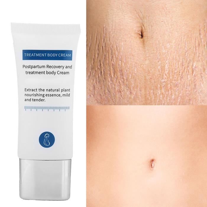 Crème Réparatrice Vergetures Maternité - 100 Ml - À Base De Beurre De Karité Et Karité - Bio