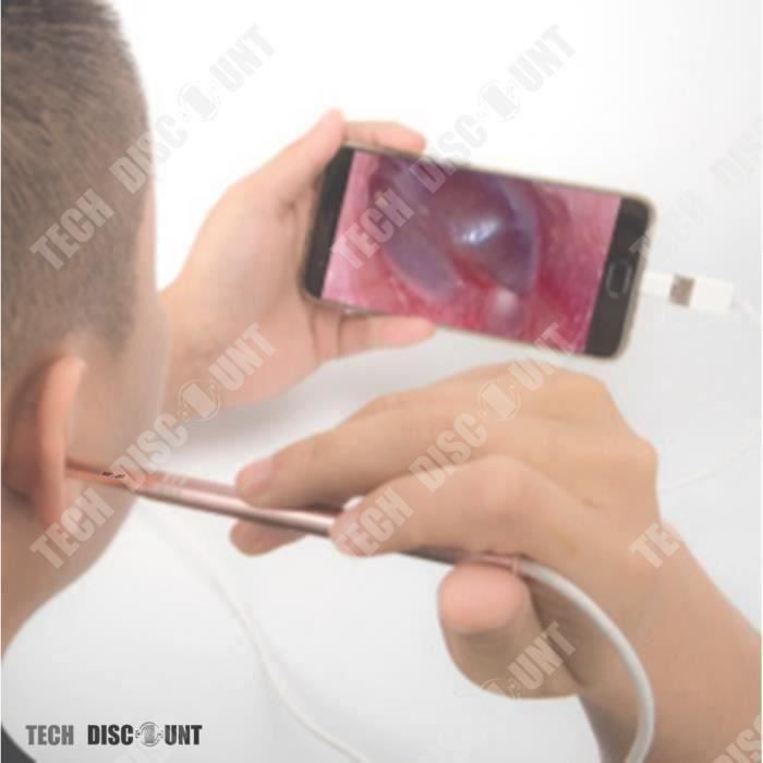 Otoscope professionnel medicale pediatrique oreille humain enfant
