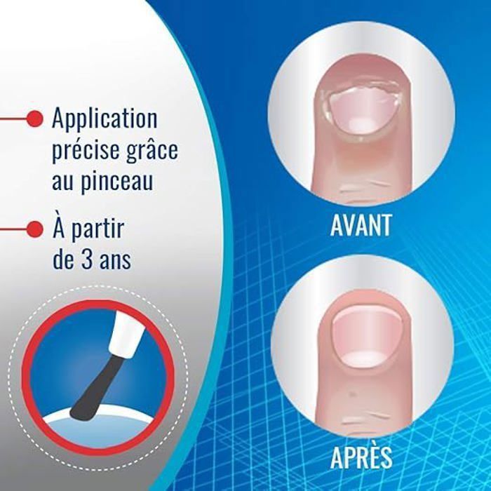 Stylo Anti-rongement D'ongles - Goût Amer, Non Toxique, 2 Pièces De 5 Ml, Pour Enfants Et Adultes - 3