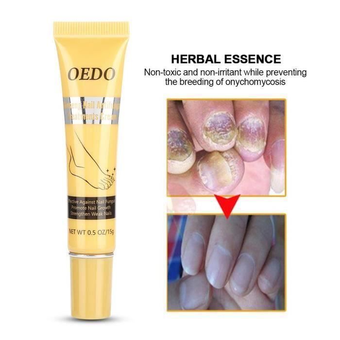 Réparateur Et Antibactérien Pour Les Ongles Solution Antifongique Contre La Mycose Des Ongles Pour Pieds Et Mains 15g