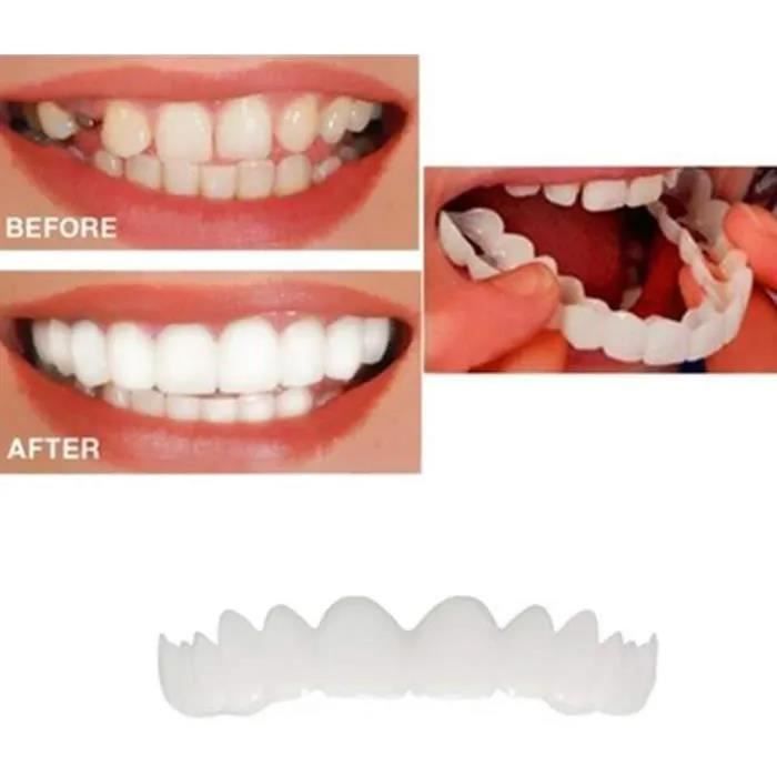 Flipped Warmth 1 Paire Dent Provisoire Fausse Dent Dentier Amovible Haut Et  Bas, Facette Prothese Dentaire, Fausses Dents Dentier Sourire Parfait Pour