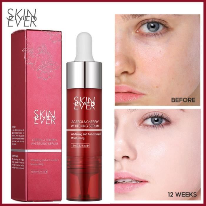 Crème Anti-Taches Foncées 7 DAYS Natural - Correcteur Taches, Cernes, Acné - Taille Voyage 1.76 Oz