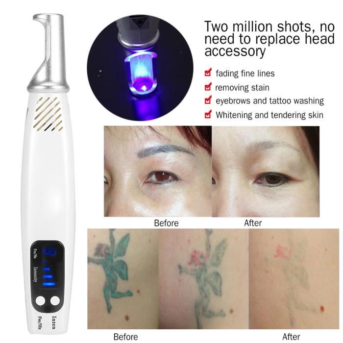 ZJCHAO Stylo laser picoseconde Dispositif de beauté de peau de machine de retrait de tache de rousseur de cicatrice de tatouage de