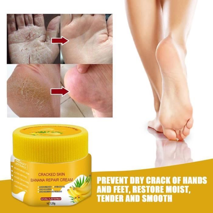 Zerodis Creme Talons Crevasses Creme pour talons craqueles Soin des pieds La creme a la banane soulage la peau beaute mains Mixte Cdiscount Au quotidien