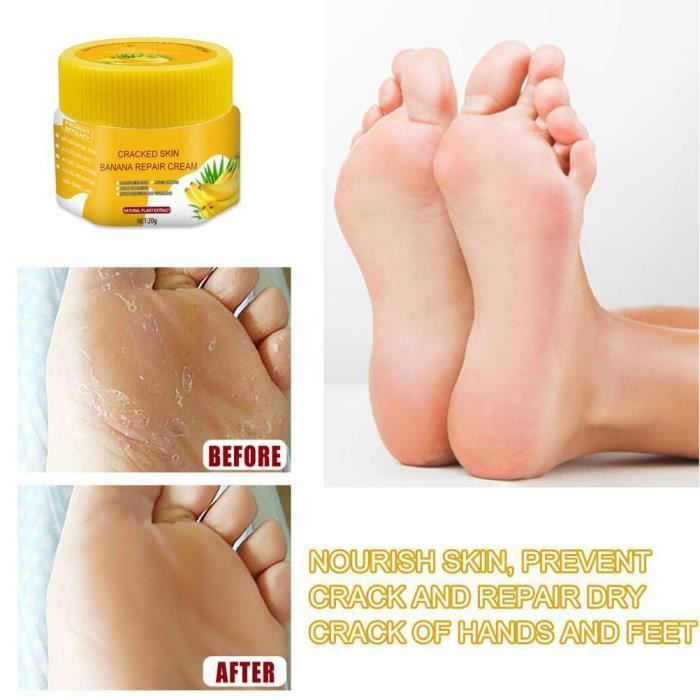 Zerodis Creme Talons Crevasses Creme pour talons craqueles Soin des pieds La creme a la banane soulage la peau beaute mains Mixte Cdiscount Au quotidien