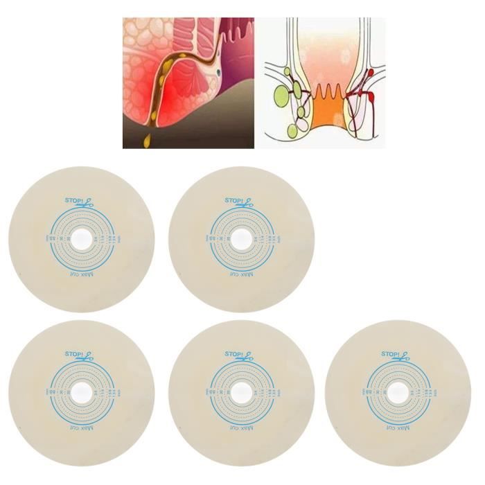 5 Pcs Boite Sac De Stomie Poche De Couverture De Stomie Urine Fixe Ouverture Jetable De A 45 Mm Chassis N 45 Nim Cdiscount Puericulture Eveil Bebe