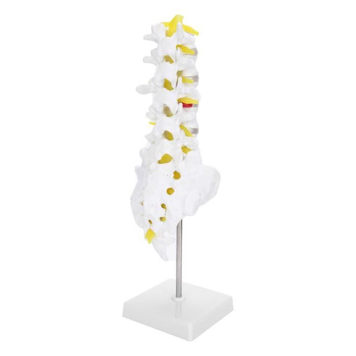 Flèches Carbon Express Medallion XR 700 - 8 Arbres + 4 Flèches Finies Jamais Tirées - 29 Pouces