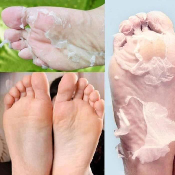 Papaye chaud enlever peau morte masque de pied peeling cuticules talon pieds soins anti vieillissement G22587