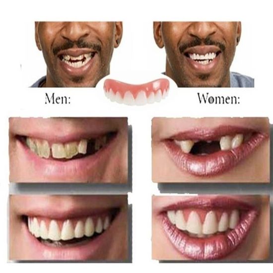 Perfect smile veneers Silicone faux soins dentaires instantanés Secure placages de dents d'hygiène bucco-dentaire naturelle