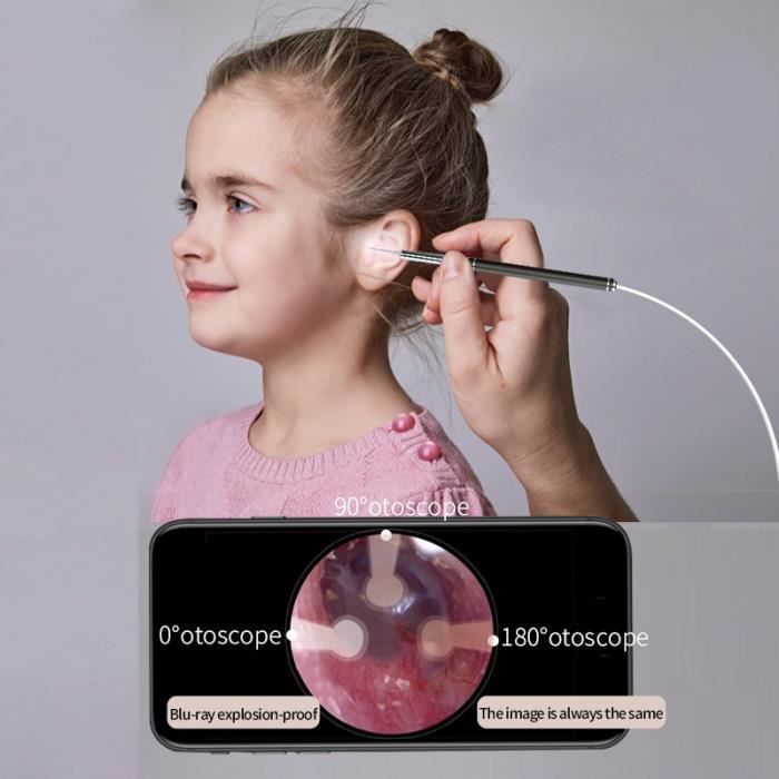 Otoscope Oreille Endoscope Caméra Oreille Visuelle Intelligente HD Kit de  Nettoyage d'oreille avec Lumière LED 1600P WIFI - Cdiscount Electroménager
