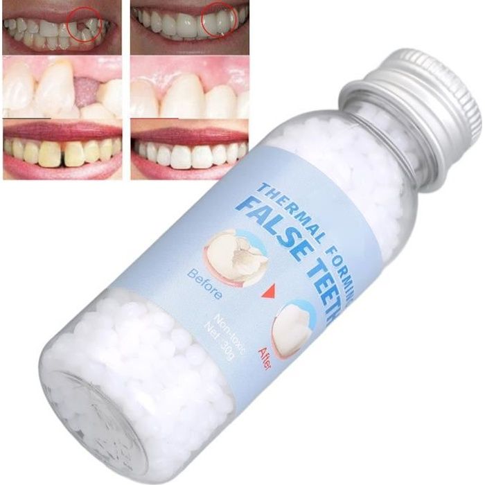 Colle de dent Kit de colle de soin dentaire d'opération simple de matériel sûr de colle de réparation de dent DUO