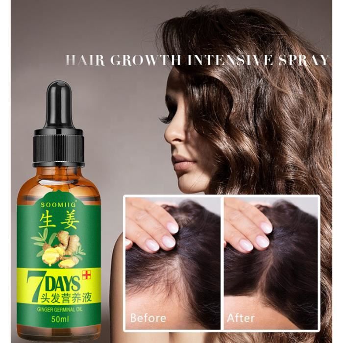 Huile de croissance des cheveux germinale au gingembre 30 ml Huile de  traitement de la perte de cheveux Huile de soins capillaires - Cdiscount Au  quotidien