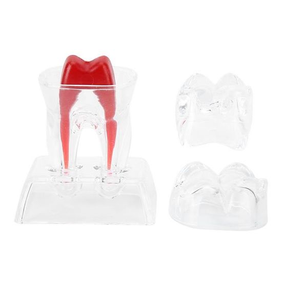 10 Blocs D'entraînement Endodontique - Modèles De Dents Avec Canaux Radiculaires Pour Pratique Dentaire