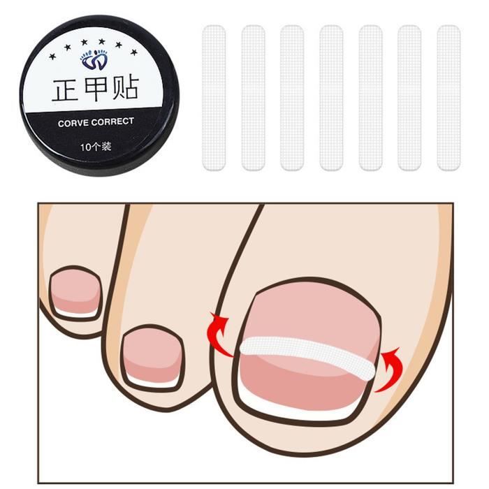 Correcteur D'Ongles Incarnés Et Oignon - Acier Inoxydable, Taille 4x2.5cm - Neuf
