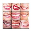 2 Paires Prothèse Dentaire Cosmétique, Fausse Dent Naturel a Poser, Dentier Sourire Parfait,Dentier Provisoire Dentier Amovible Haut-2