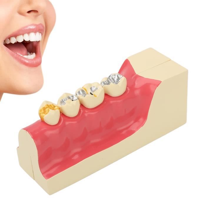TD® appareil dentaire alignement de dents nettoyage transparent bague dent  droite de nuit enfant jour adulte protection boite solid - Cdiscount Au  quotidien