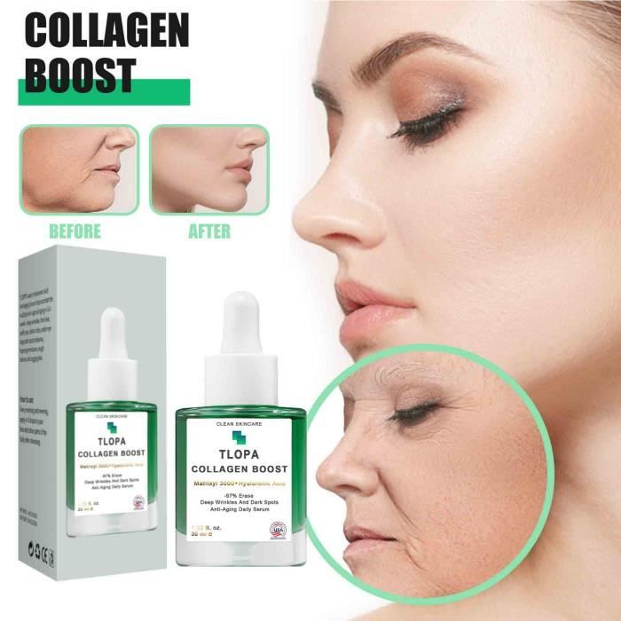 Collagène + Vitamine + Acide Hyaluronique Anti-âge - Réduit Les Rides Et éclat, Neuf