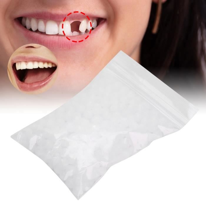Kit De Réparation Dentaire Temporaire - Pour Dents Cassées, Remplissage Blanc - Neuf