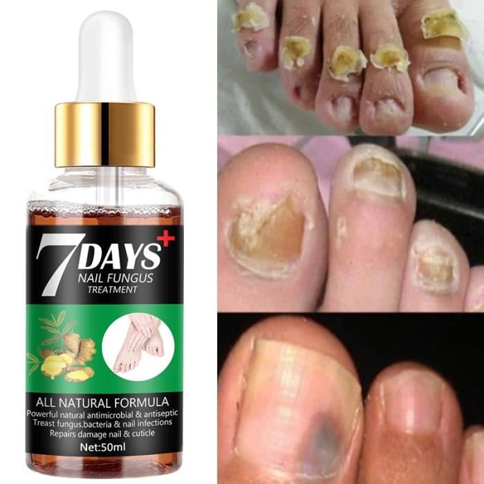 (20ml)SUAI traitement antifongique des ongles, Essence de soin pour — free download