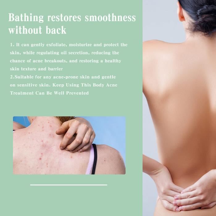 Spray de traitement de l'acné du dos, sérum anti-taches pour le ...