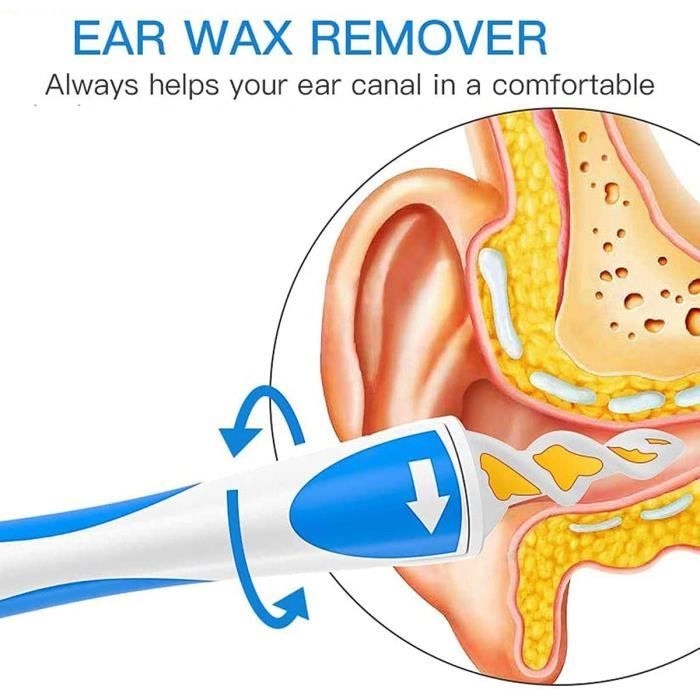 Nettoyant Oreille,Cire d'oreille Remover - Spiral Ear Cleaner - Outil pour  enlever la Cire d'oreille. Ear Cleaner System * 2avec 32 Embouts lavables.
