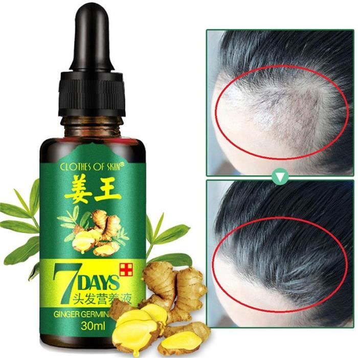 30 Ml Huile Essentielle Pousse Cheveux Rapide Comtervi Densificateur Serum Ginseng Gingembre Cdiscount Au Quotidien