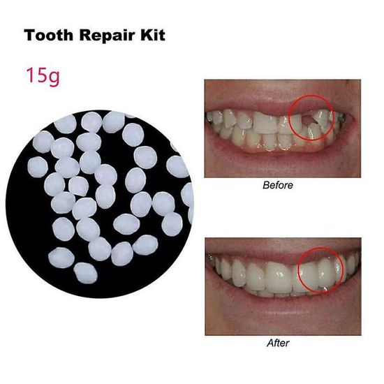 3050g Réparation dentaire Colle Résine Résine Prothèse dentaire — free download