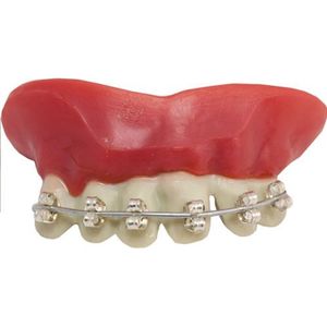 Dentier Appareil Dentaire Achat Vente Pas Cher
