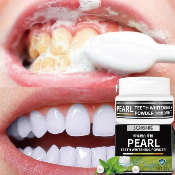 de blanchiment des dents en perles,produits éclaircissants pour enlever la plaque dentaire SAF,hygiène buccale[F912449368]