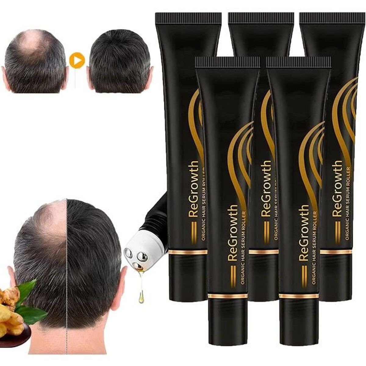 Regrowth Organic Hair Serum Roller Set, Organic Hair Regrowth Serum