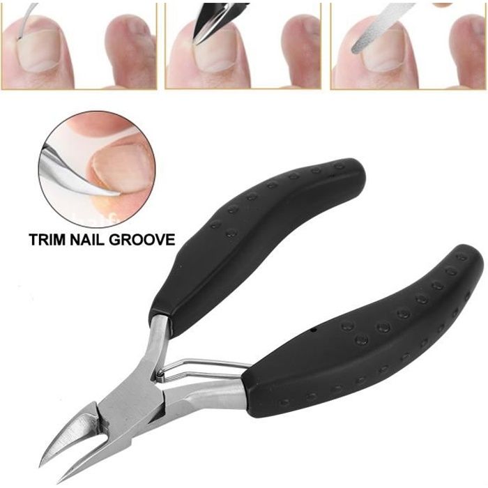 Coupe-Ongles Incarnés en Acier Inoxydable Professionnel Tondeuse à Ongles Outil de Pédicure(Noir ) -JIA