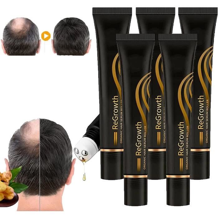 Regrowth Organic Hair Serum Roller Set, Organic Hair Regrowth Serum