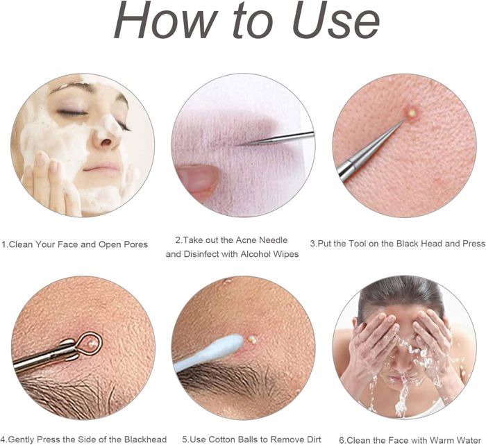 Lot De 4 Tire-comédons – Pour Points Noirs Et Acné – Soin Du Visage – Neuf