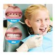 2 Paires Faux Dentier Sourire Parfait, Dent Provisoire Fausse Dent Dentier Amovible Haut et Bas, Facette Prothese Dentaire, Fausses-1