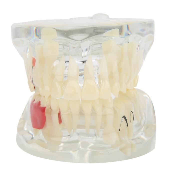 Modèle De Dents D'enfant 24 Pièces Amovible Pour L'apprentissage Et La Préparation Dentaire