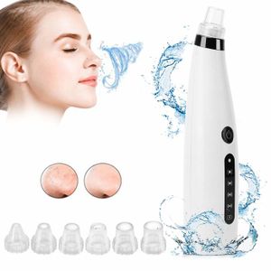 Nettoyant Visage MEDIA WAVE Store® - Suction Pour Pores, Boutons Et Impuretés - Neuf