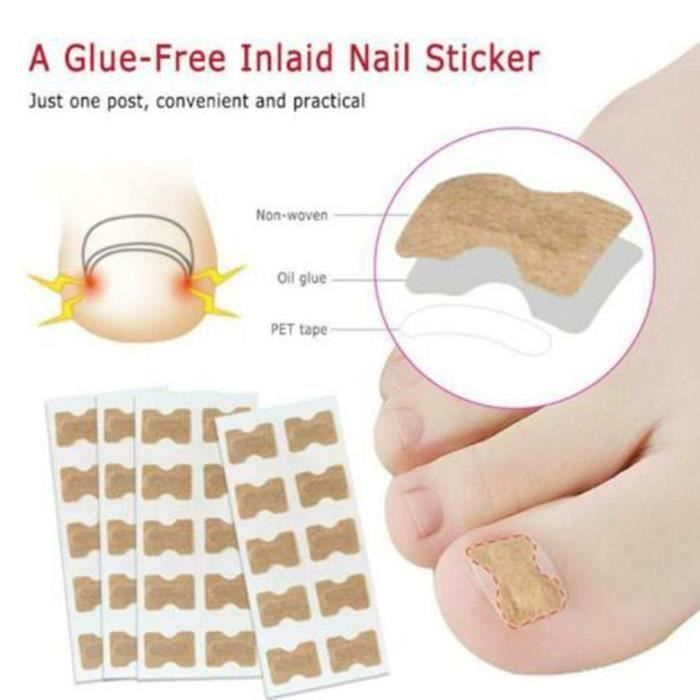 Lot de 50 Autocollants de Correction pour Ongles Incarnés en Coton Élastique Respirant Avec Ruban Adhésif Double Face