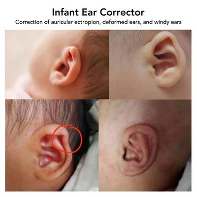 Correcteur oreille bebe - Cdiscount