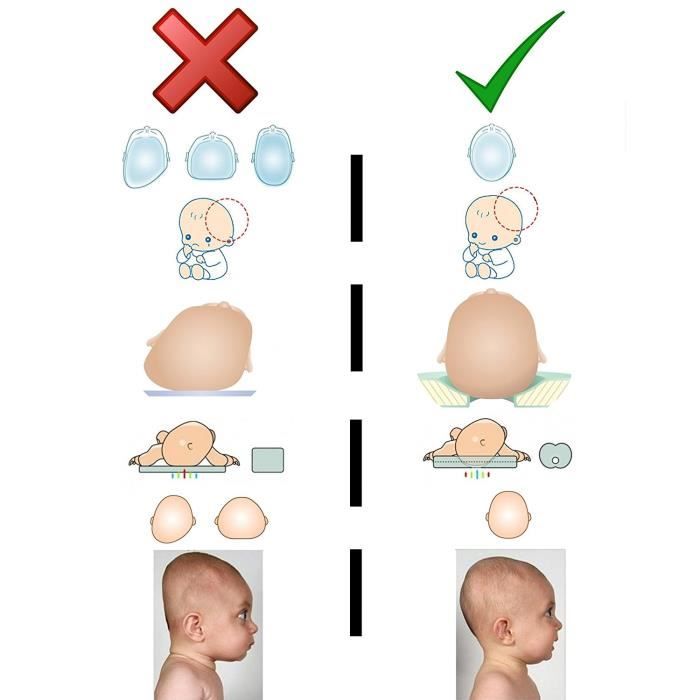 Tete Plate B?B? 3 Mois halfunctional
