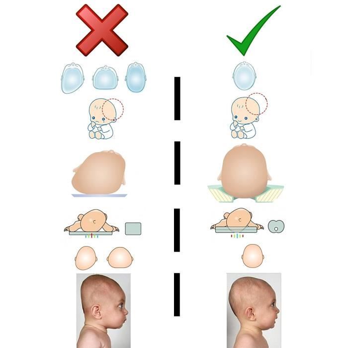 Coussin de positionnement latéral - Plagiocéphalie - O'Monde